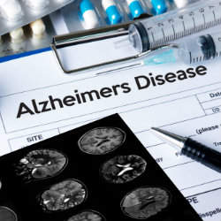 alzheimers disease web