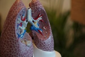 UK MHRA approves Vertex’s Alyftrek for cystic fibrosis