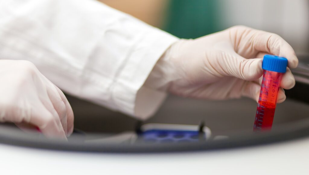 Researcher,Holding,A,Test,Tube