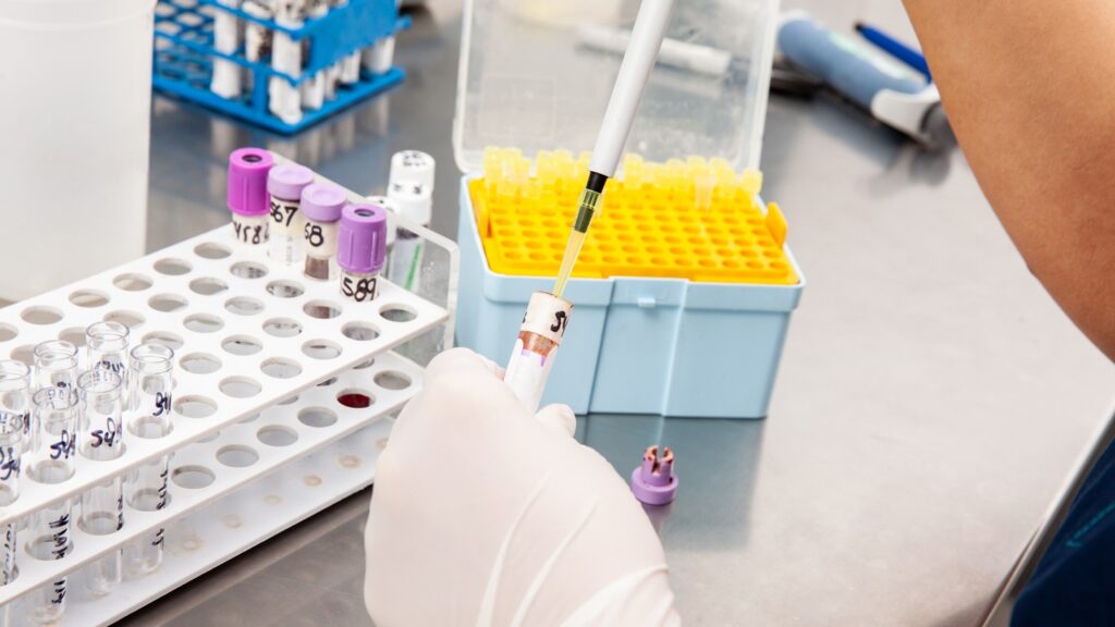 Scientist,Preparing,Bone,Marrow,Samples,For,Flow,Cytometric,Analysis,In