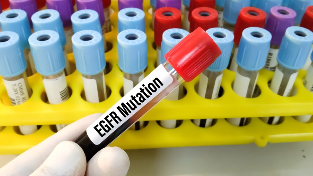 Molecular,Biologist,Holding,Blood,Sample,For,Egfr,Mutation,Test,For