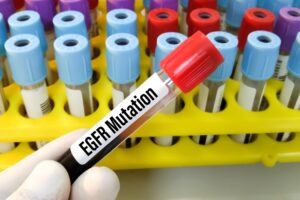 J&J’s Rybrevant Faspro gains FDA approval for new dosing in NSCLC