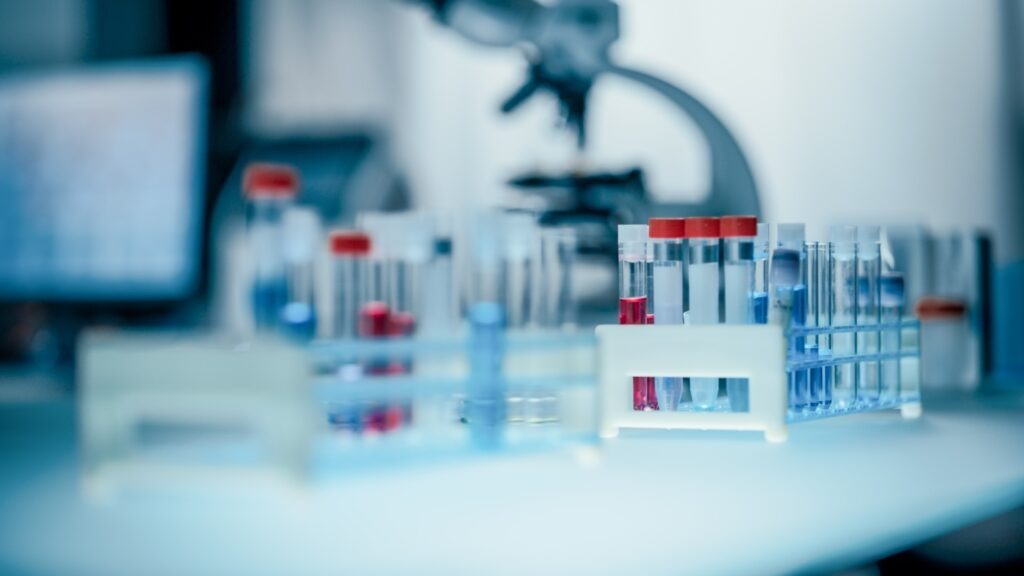 Close,Up,Of,A,Wide,Range,Of,Test,Tubes,With