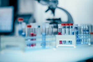 REGENXBIO receives FDA response for RGX-121 application