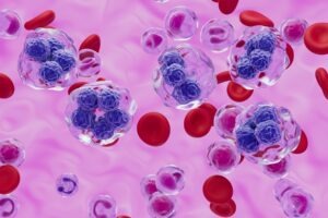 Citius Oncology and Uniphar sign European distribution deal for Lymphir