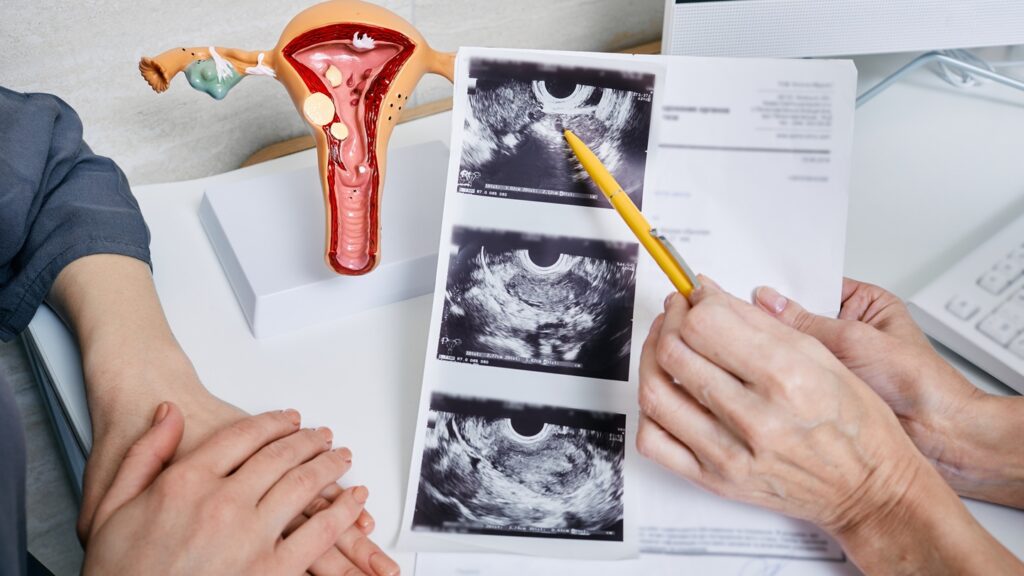Gynecology,,Women's,Health.,Gynecologist,Showing,To,Woman,Ultrasound,Of,Her