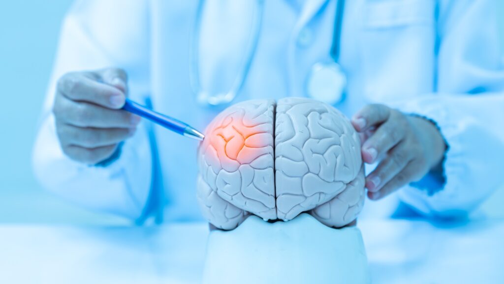 Neurologist,Hand,Pointing,Brain,Anatomy,Human,Model,And,Brain,Disease