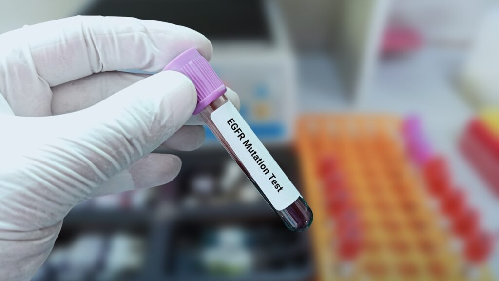 Lab,Technologist,Holds,Blood,Sample,For,Egfr,Mutation,Test,With
