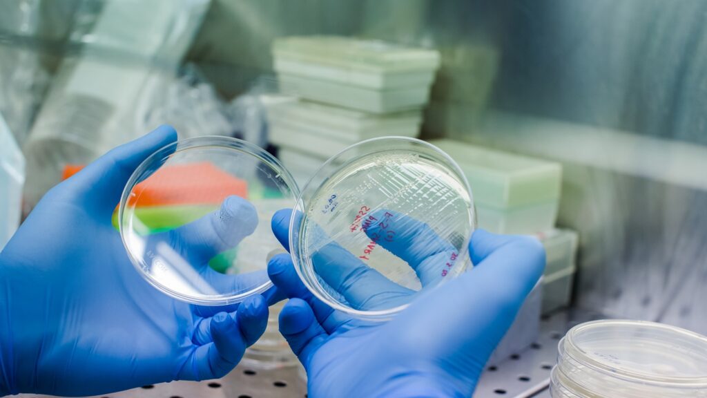 Growing,Bacteria,To,Create,Car,Therapy,-,The,Novel,Method