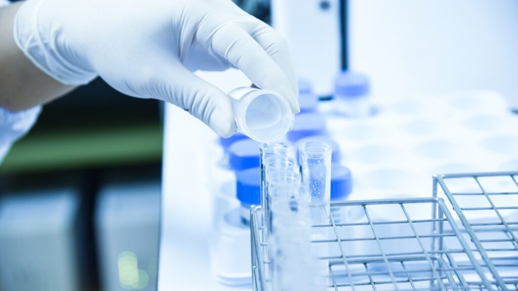 Scientist,Hand,Holding,A,Test,Tube.,Biochemistry,Laboratory,Research.