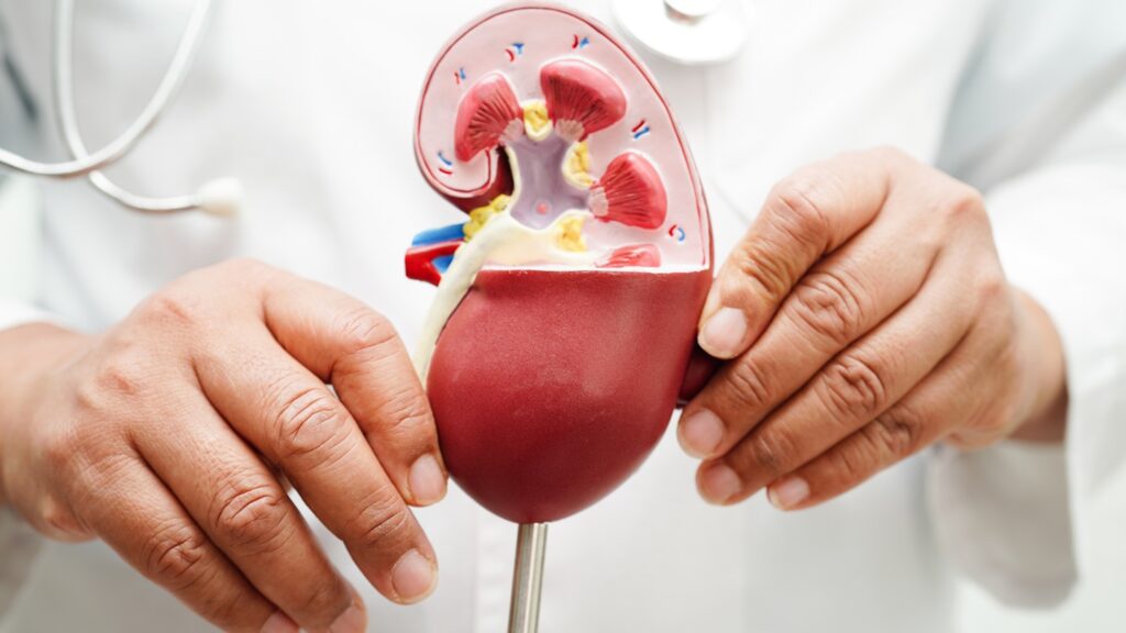 Chronic,Kidney,Disease,,Doctor,Holding,Model,For,Treatment,Urinary,System,