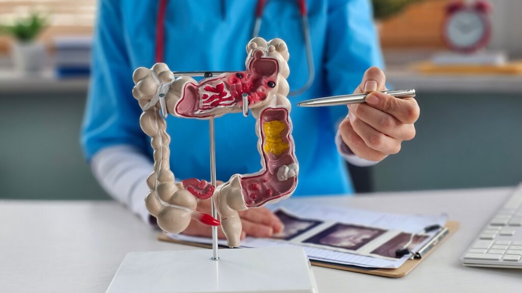 The drug targets for IBD will be discovered using the somatic genomics platform technology. Credit: NMK-Studio / Shutterstock.com.