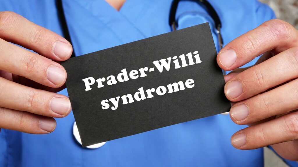 Soleno’s lead product Vykat XR is intended for Prader-Willi syndrome. Credit: Yuriy K / Shutterstock.com.