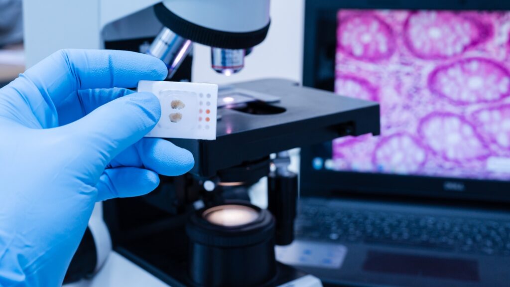 Prenosis incorporates multi-dimensional biological data and machine learning to detect clinically meaningful patterns in complex diseases. Credit: Komsan Loonprom / Shutterstock.com.