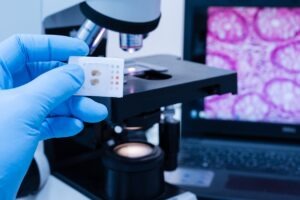 BioAegis and Prenosis partner for inflammatory disease therapies