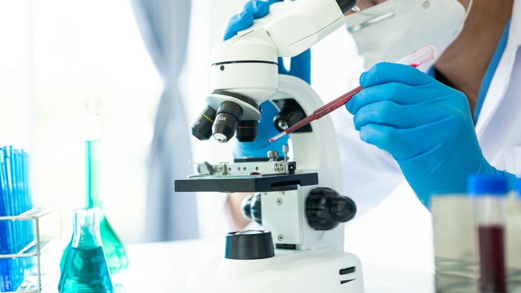 Safety findings for Sotyktu were generally consistent with those observed in plaque psoriasis. Credit: SaiArLawKa2 / Shutterstock.com.