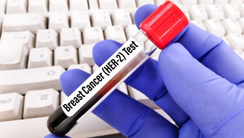 In the neoadjuvant setting, the therapy is approved for adults with HER2-positive stage 2 or stage 3 breast cancer. Credit: Arif biswas / Shutterstock.com.