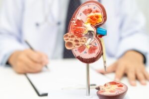 FDA grants priority review to Roche’s Gazyva/Gazyvaro for pMN