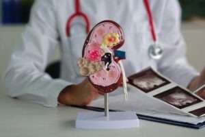 FDA grants traditional approval to Novartis’ Fabhalta for IgAN