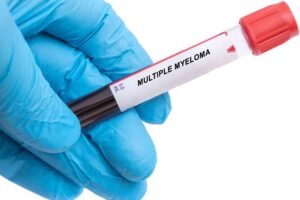 Johnson & Johnson’s multiple myeloma treatment secures EC approval