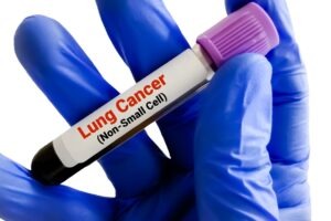 Akeso secures China NMPA authorisation for ivonescimab combo