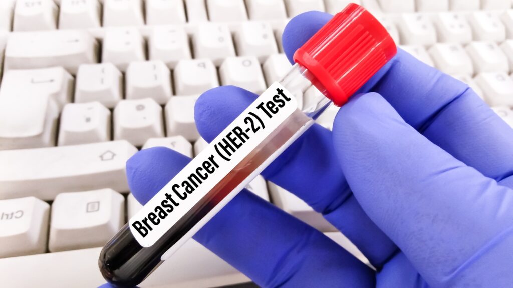 Ziihera, a bispecific HER2-directed antibody, is also indicated in the US for previously treated HER2+ biliary tract cancer. Credit: Arif biswas / Shutterstock.com.