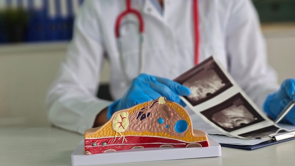 The combo is approved for adults with locally advanced or metastatic breast cancer. Credit: NMK-Studio / Shutterstock.com.