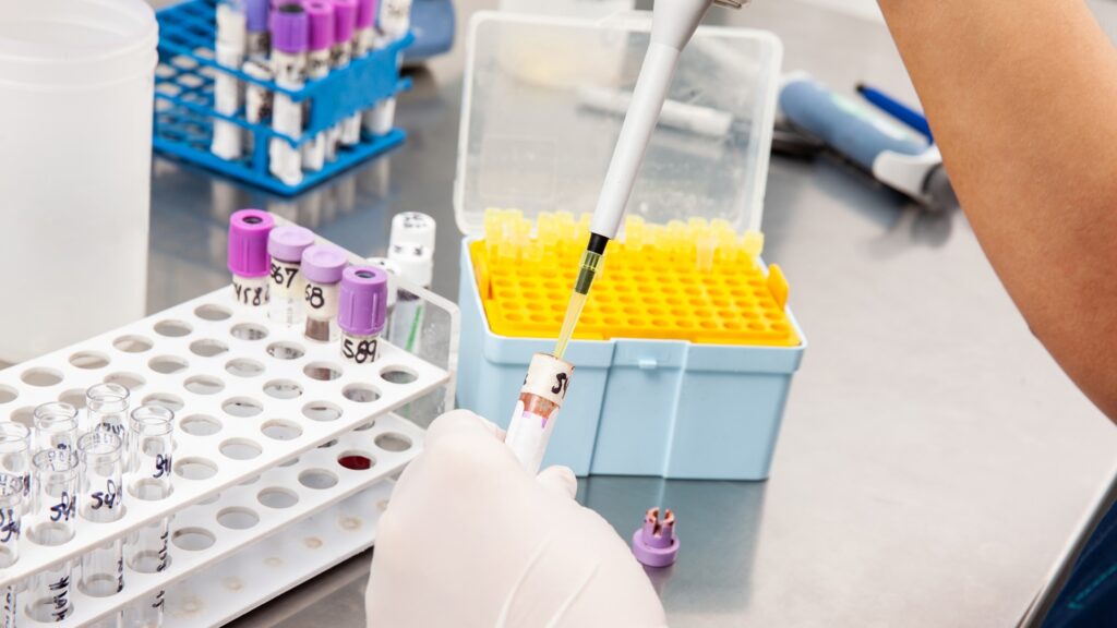 The licensed VHH antibody molecule originates from RenNano, Biocytogen’s technology designed to identify fully human VHH antibodies. Credit: Anamaria Mejia / Shutterstock.com.