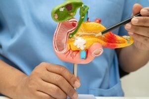 Genialis and Inventia to enhance pancreatic cancer treatment testing
