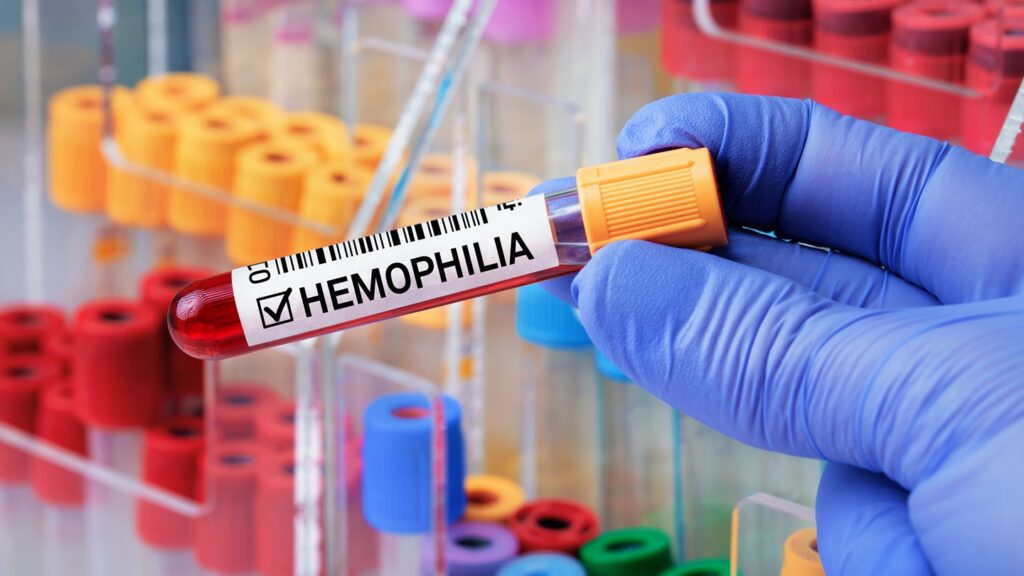 The biosimilar candidate is intended to reference Hemlibra (emicizumab), which addresses haemophilia A, a genetic disorder. Credit: angellodeco/Shutterstock.com.