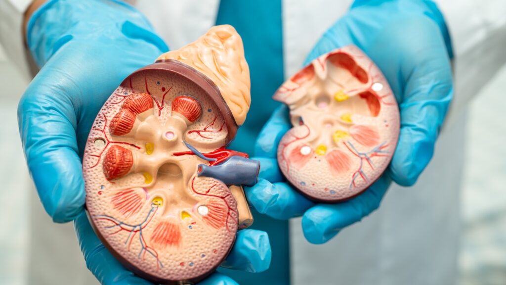 Kidney,Disease,,Chronic,Kidney,Disease,Ckd,,Doctor,With,Human,Model
