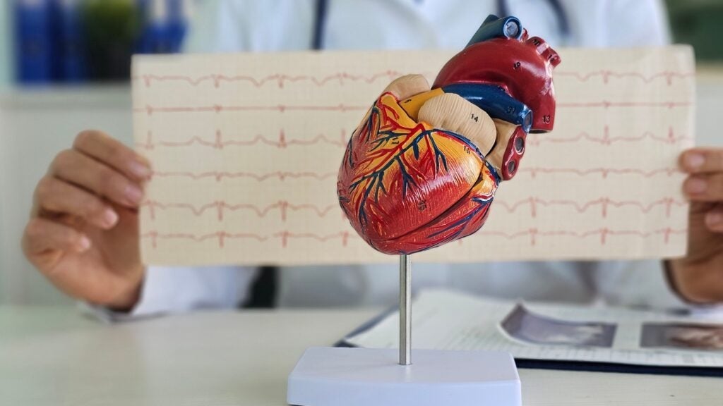 Camzyos was initially approved by the FDA in 2022 for adult patients with symptomatic NYHA class II-III oHCM. Credit: NMK-Studio / Shutterstock.com.