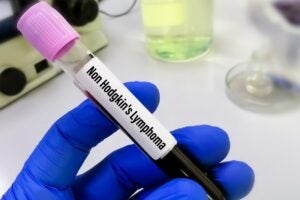 FDA approves expanded indication for Lilly’s Jaypirca