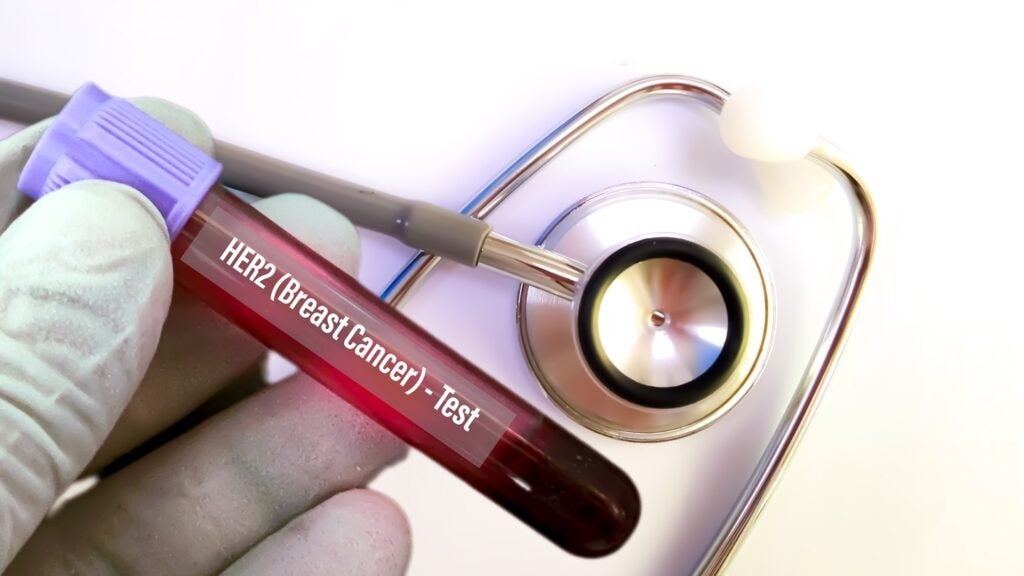 The regimen is indicated for adults with unresectable locally advanced or metastatic HER2+ disease following induction treatment. Credit: Arif biswas/Shutterstock.com.