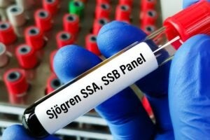 FDA approves Cosette’s Evoxac oral solution for Sjögren’s disease