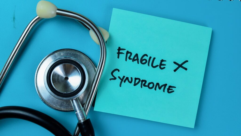 FXS is an inherited neurodevelopmental disorder stemming from FMR1 gene alterations. Credit: bangoland / Shutterstock.com.