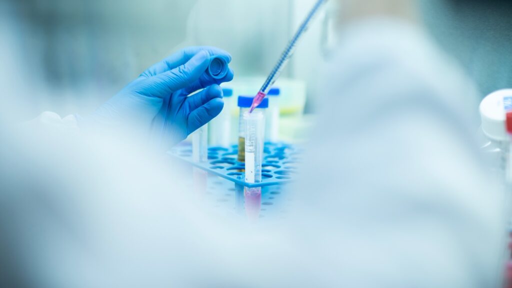 Dren Bio’s clinical programmes focus on cytotoxic T-cell lymphoma and large granular lymphocytic leukaemia. Credit: alicancomertpay / Shutterstock.com.